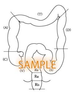 画像1: 大腸ー構成図