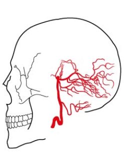 画像1: 椎骨動脈