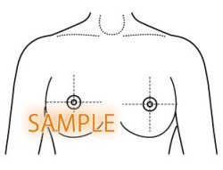 画像1: 乳 検査