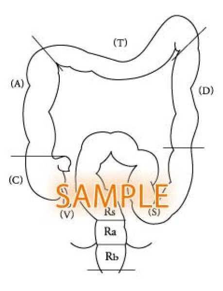 画像1: 大腸ー構成図 (1)