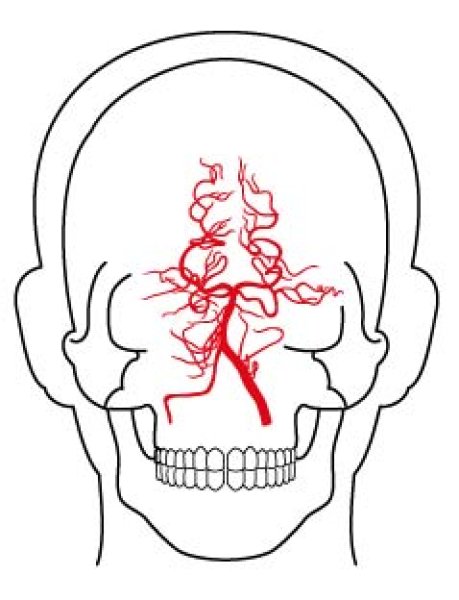 画像1: 右椎骨動脈 (1)