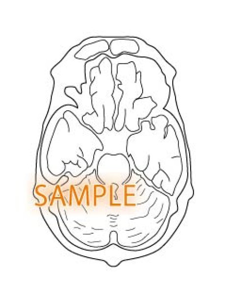 画像1: CT図-脳 (1)