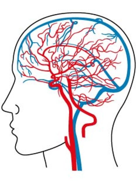 画像1: 脳内血管図 (1)