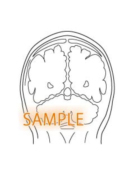 画像1: CT図-脳 (1)