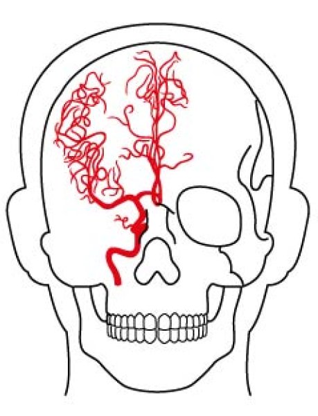 画像1: 中大脳動脈 (1)